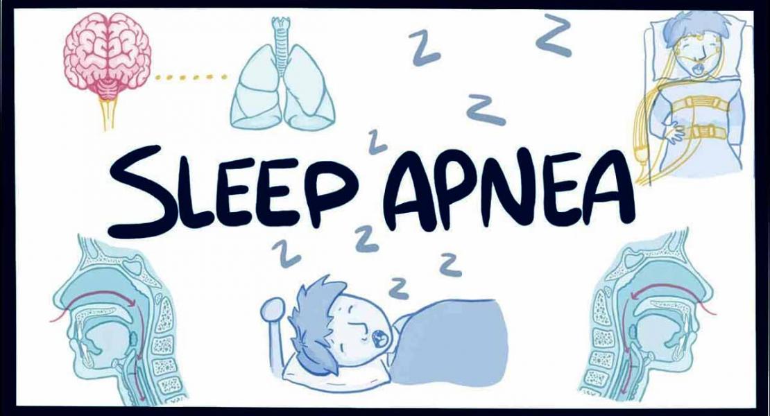 Success in Treating Sleep Apnea